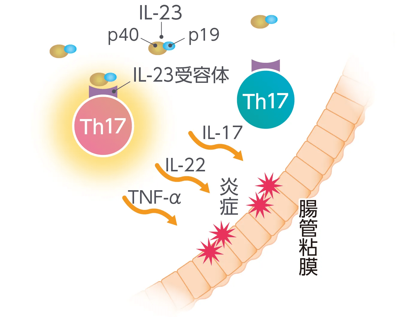 子供のクローン病はどのように診断されますか?