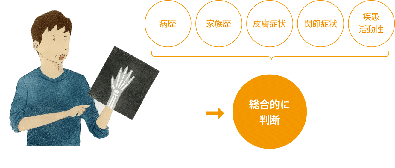 病歴 家族歴 皮膚症状 関節症状 疾患活動性 総合的に判断