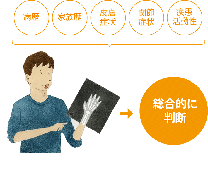 病歴 家族歴 皮膚症状 関節症状 疾患活動性 総合的に判断