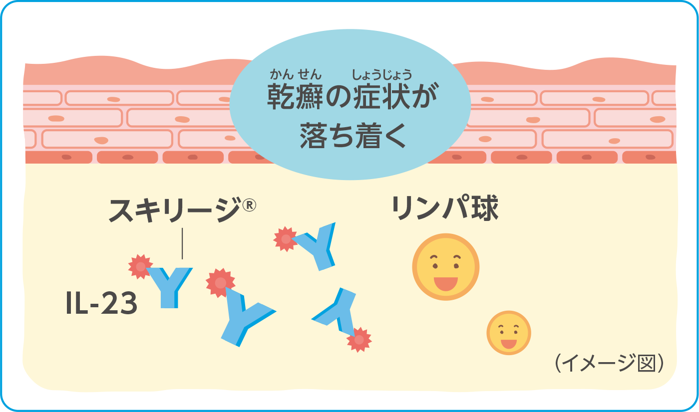 乾癬症状の改善